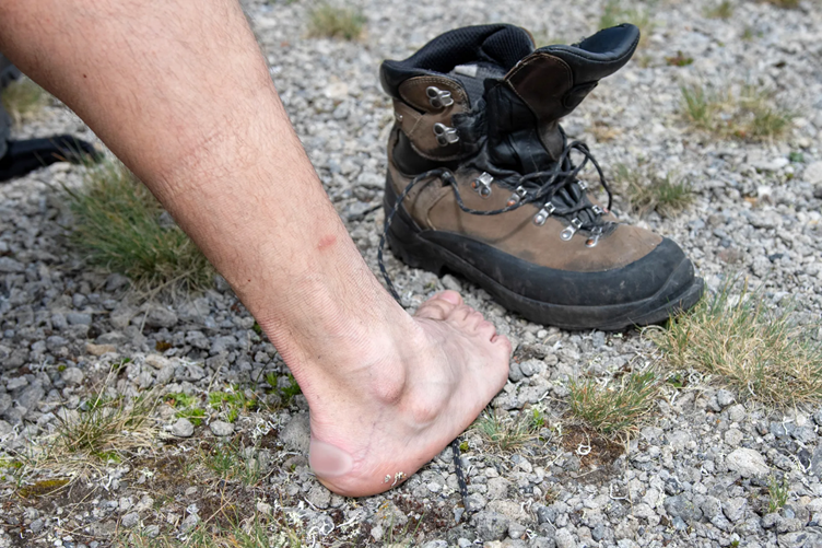 best blister plasters for hiking