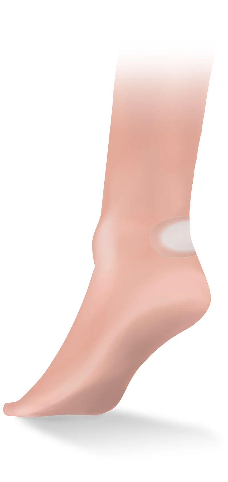 Lifesystems Blister Plasters 6-pack-4