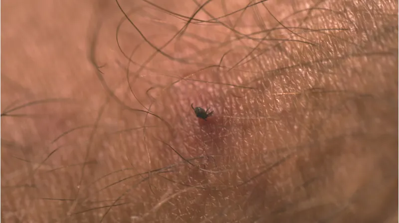 Lifesystems Tick Remover Tool-1